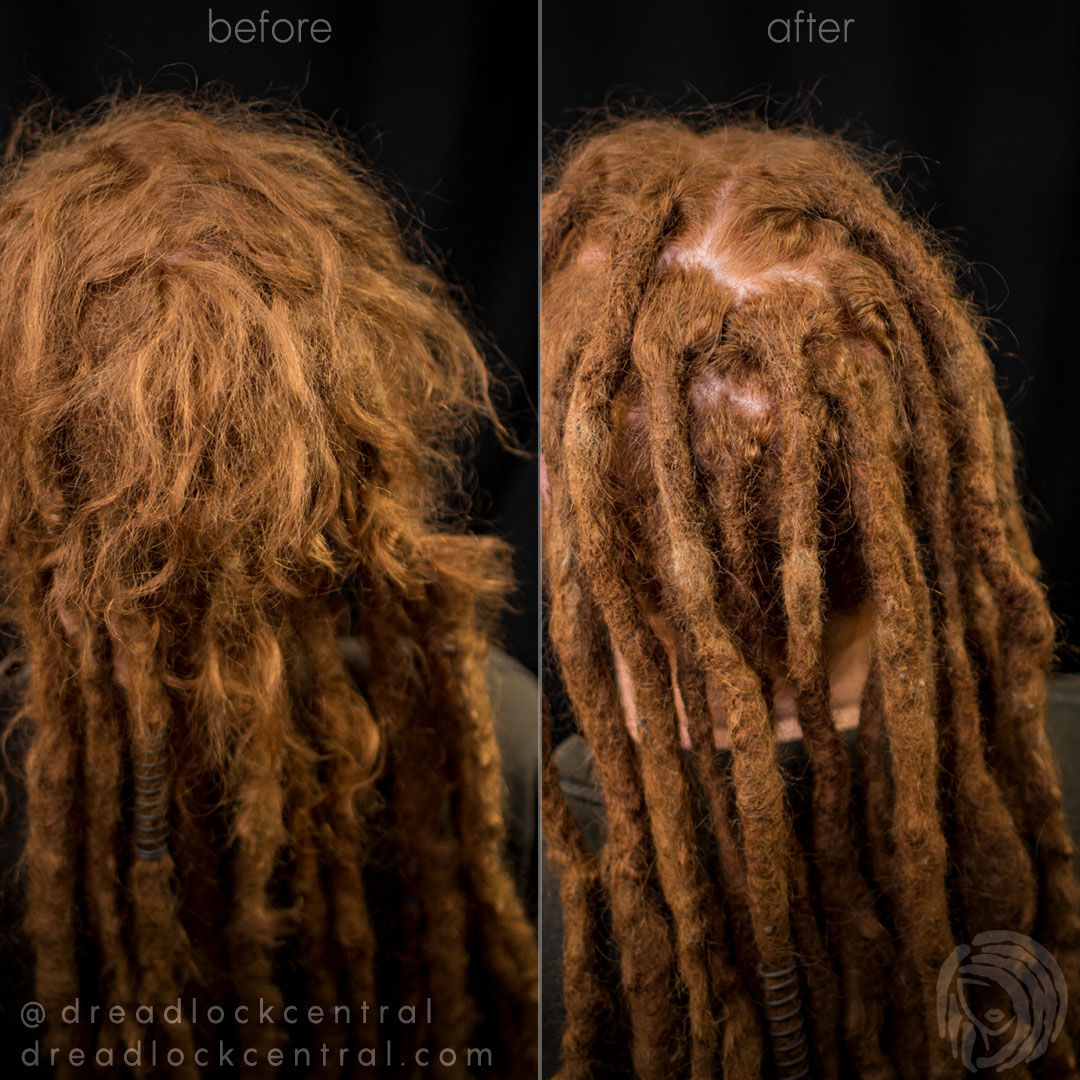 Dreadlock Reconstruction on 19 year old Dreads