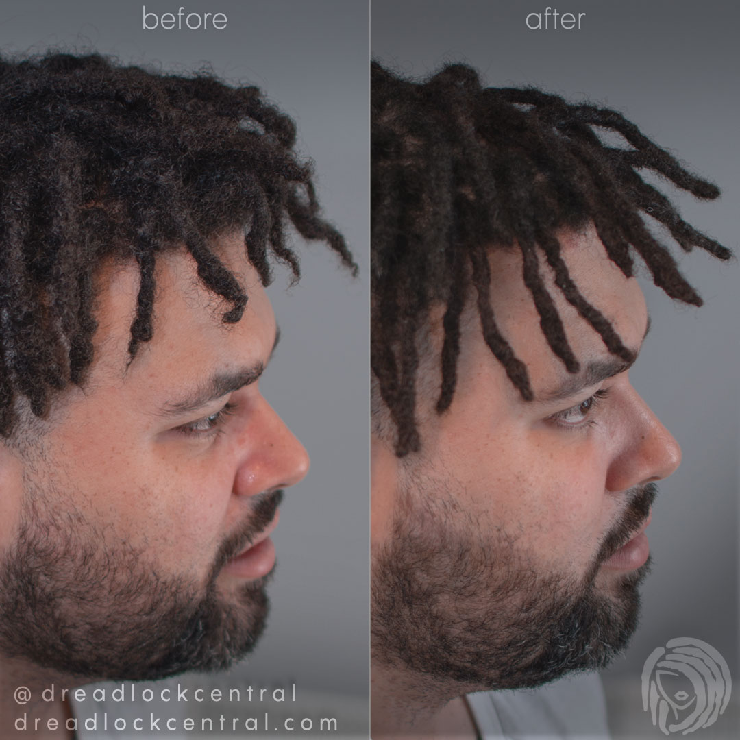 Mixed Race Dreadlock Services in Brooklyn